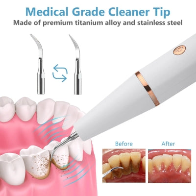 Smart Ultrasonic Teeth Cleaner & Plaque Remover (Rechargeable)