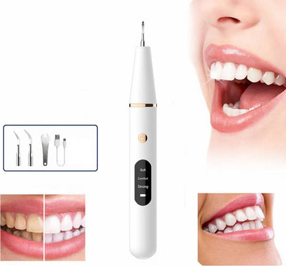 Smart Ultrasonic Teeth Cleaner & Plaque Remover (Rechargeable)