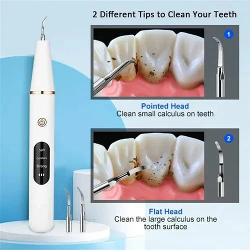 Smart Ultrasonic Teeth Cleaner & Plaque Remover (Rechargeable)