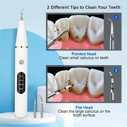 Smart Ultrasonic Teeth Cleaner & Plaque Remover (Rechargeable)
